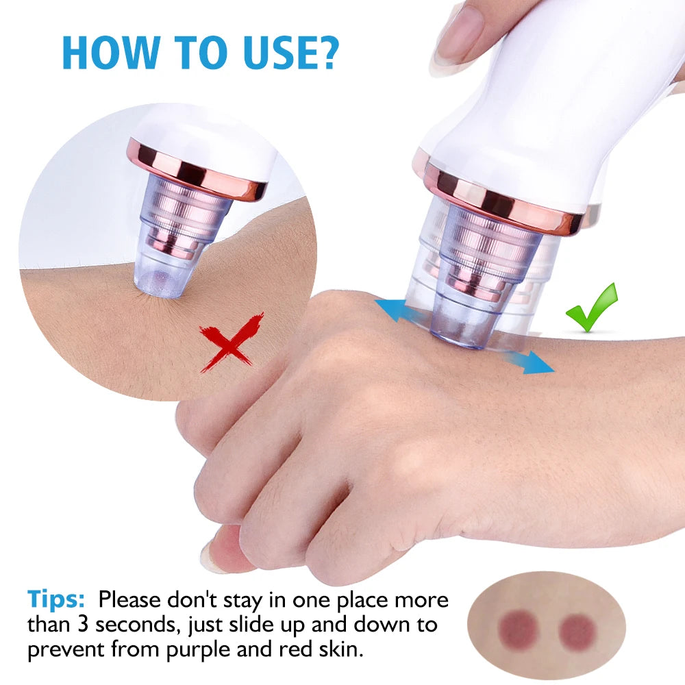 USB Rechargeable Blackhead Remover Vacuum Suction Pore Cleaner Extractor Acne Comedone Whitehead Pimple Removal Spot Cleaner